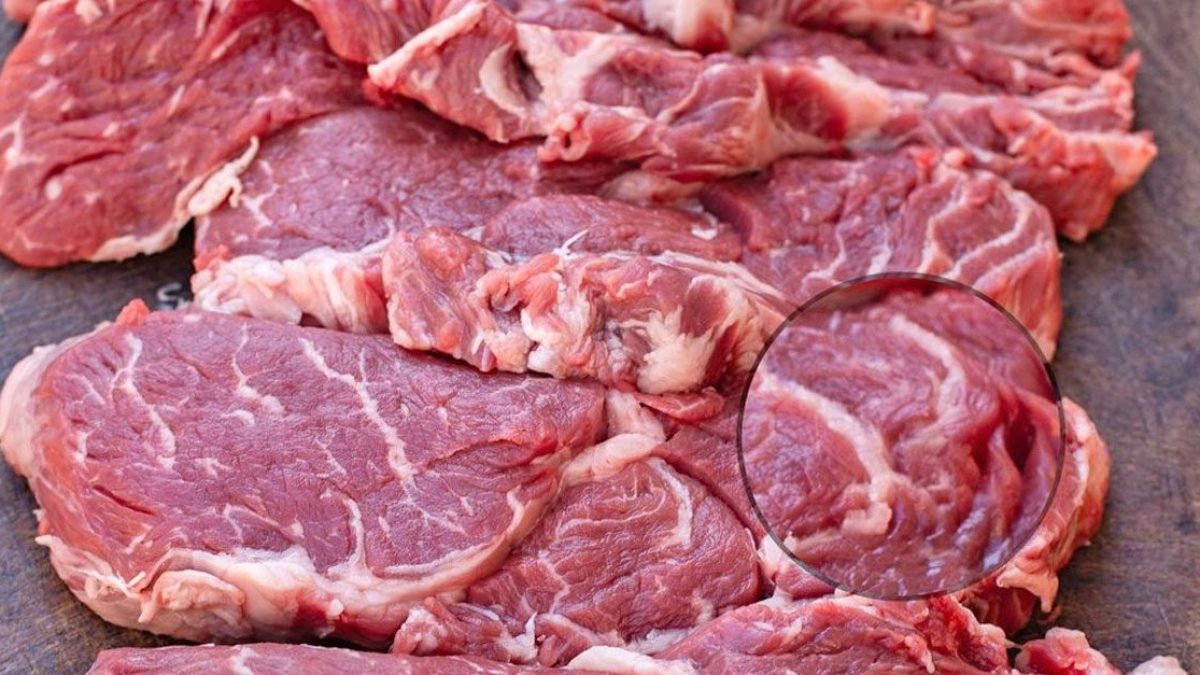 A Guide To Trichinosis Symptoms Treatment And Other 40 OFF